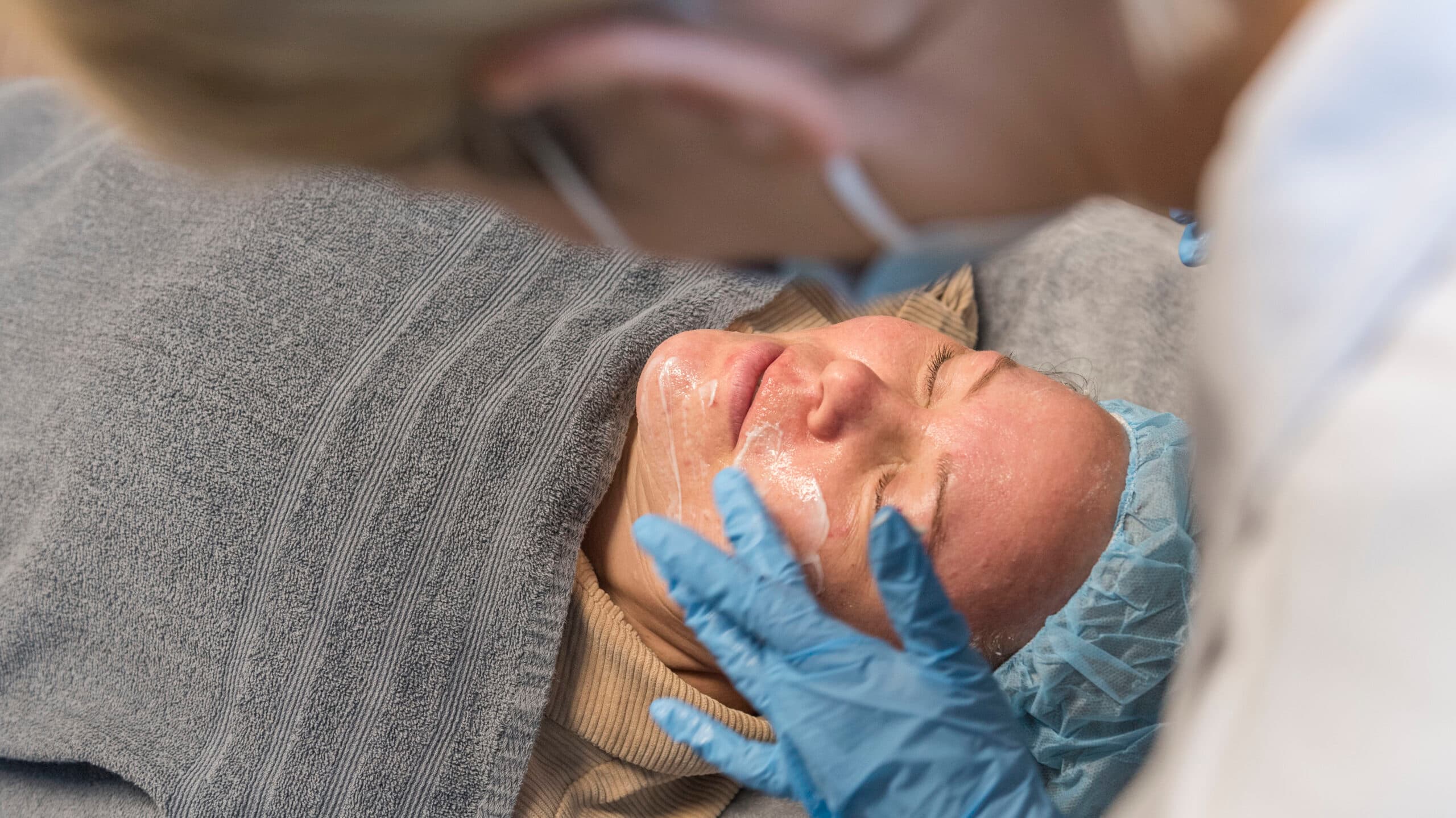 Rosacea-behandling